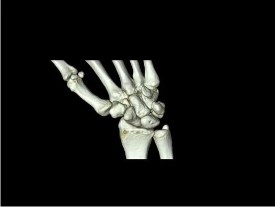 CT Dynamic Volume MSK
