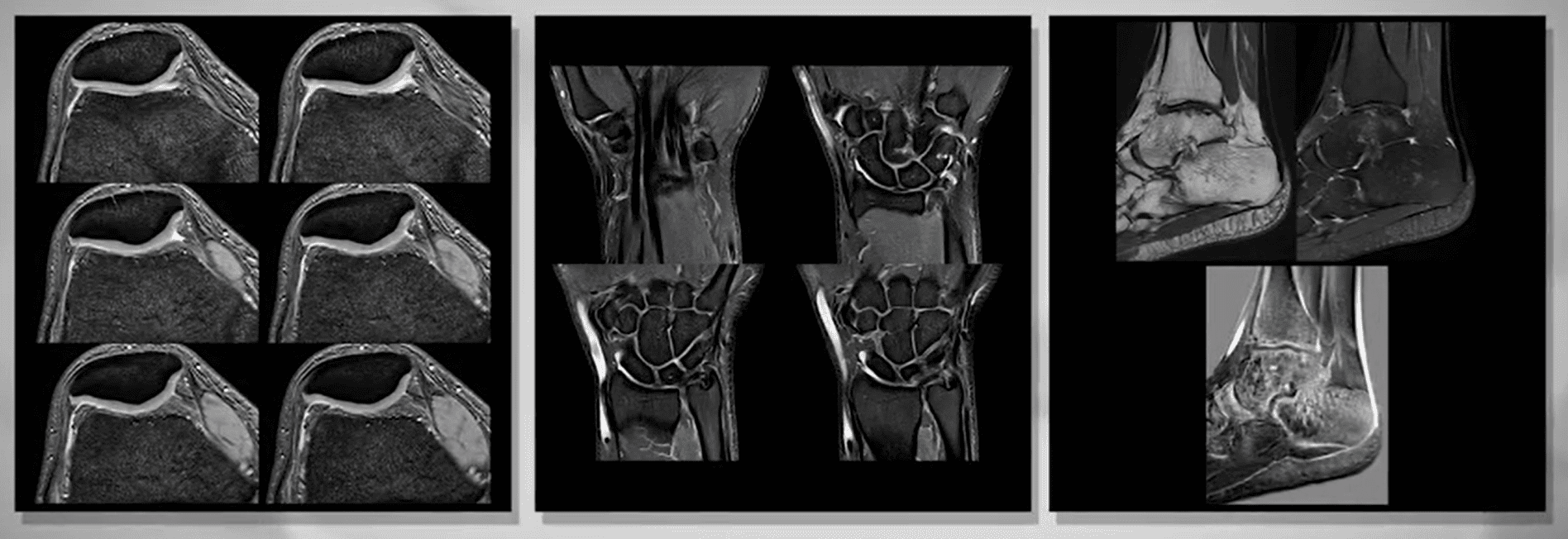 High-quality images provided by MRI Vantage Galan 3T scanner allow for better and more precise diagnosis