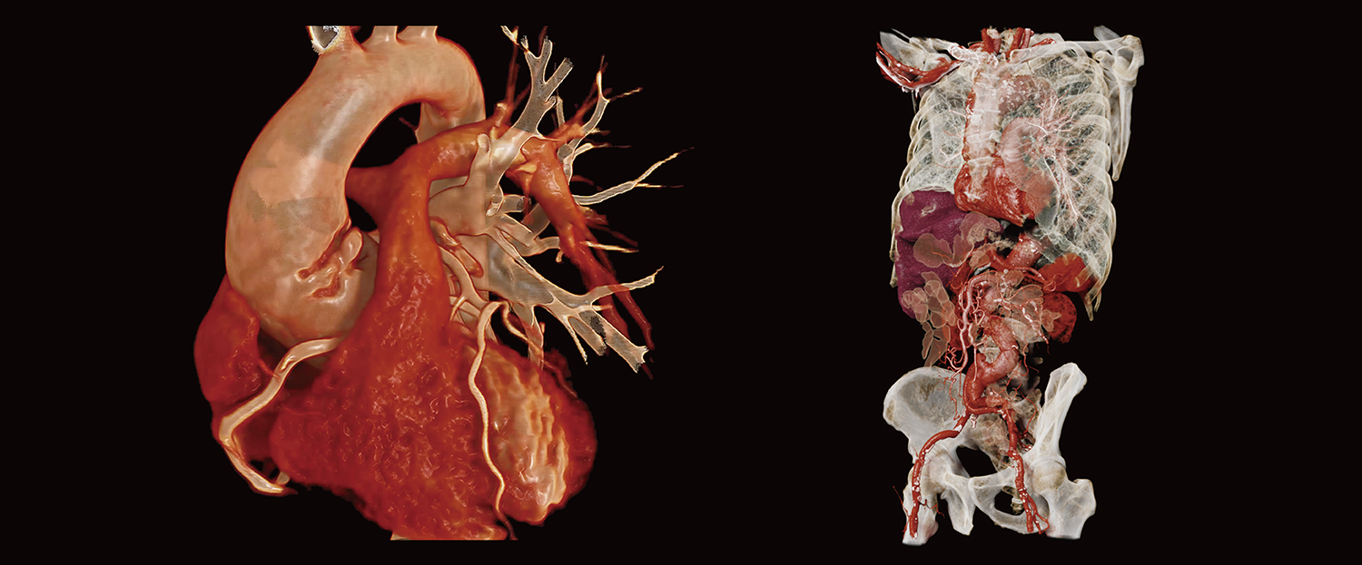 06_Cardiology_web_data orchestration_0930