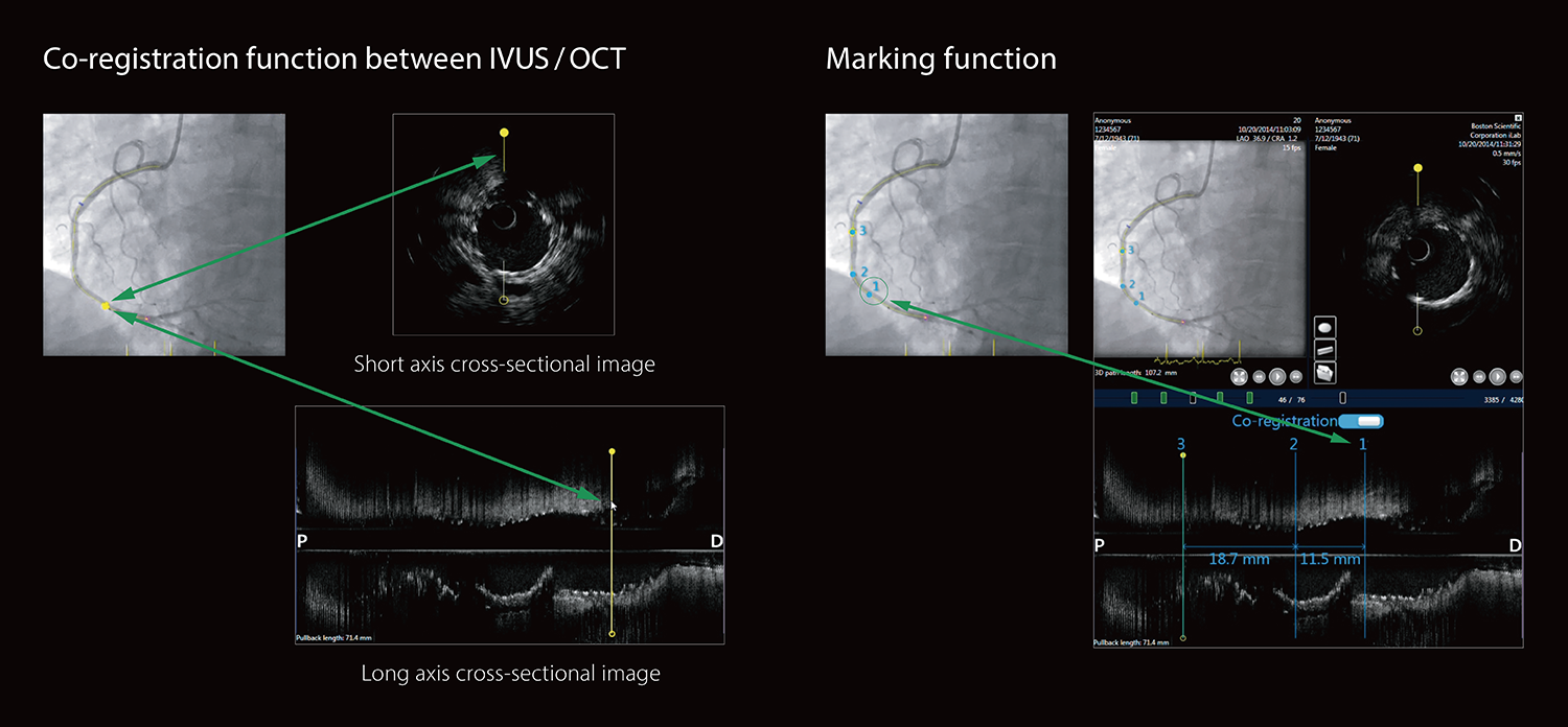 03_Cardiology_web_Ischemic_0917