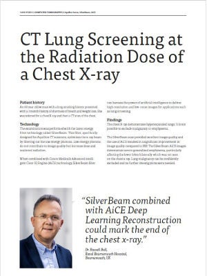CT Lung Screening