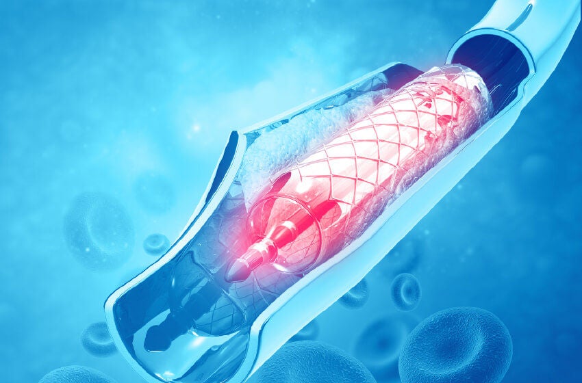Small stent imaging
