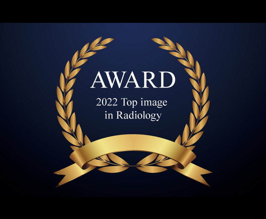figure_workflow_for INSTINX