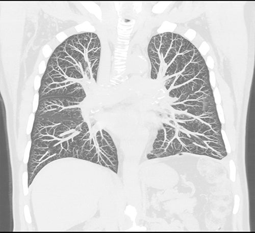 Mobile CT | Computed Tomography | Canon Medical Systems | Canon Inc.