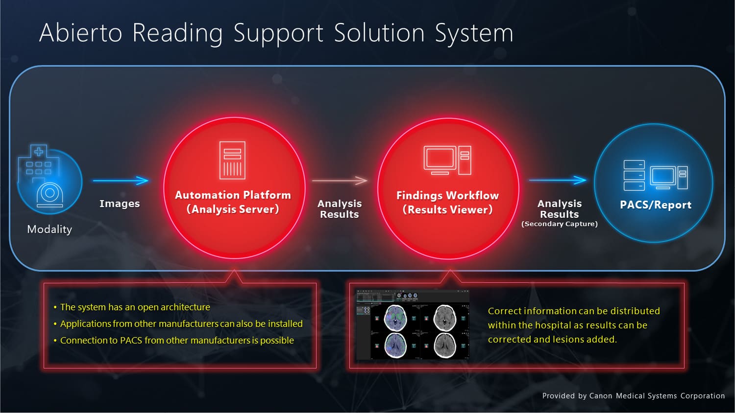 boosting-acute-stroke-care-through-ai-supported-technology