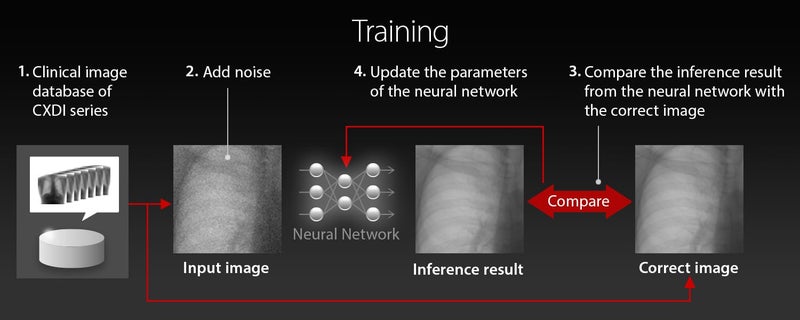 Advanced intelligent Clear-IQ Engine (AiCE) | x-ray | Canon Medical Systems