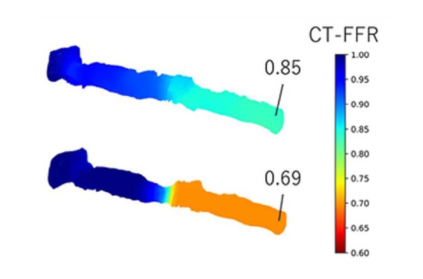 Improved accuracy of CT-FFR results