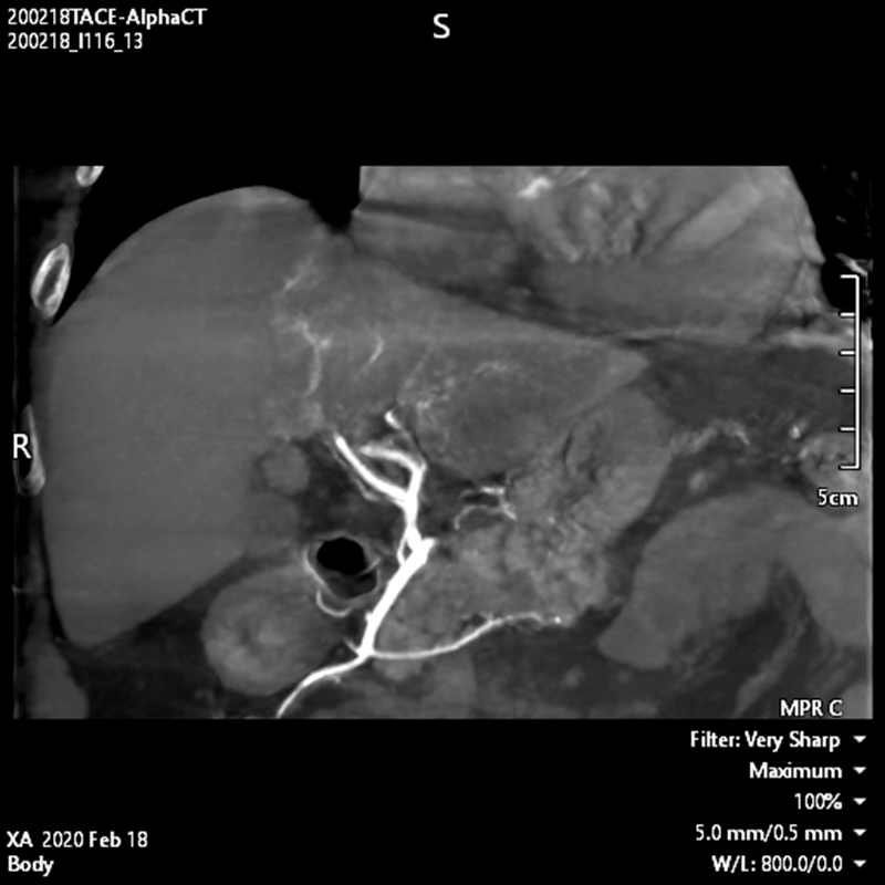 Alphenix Hi-Def imaging