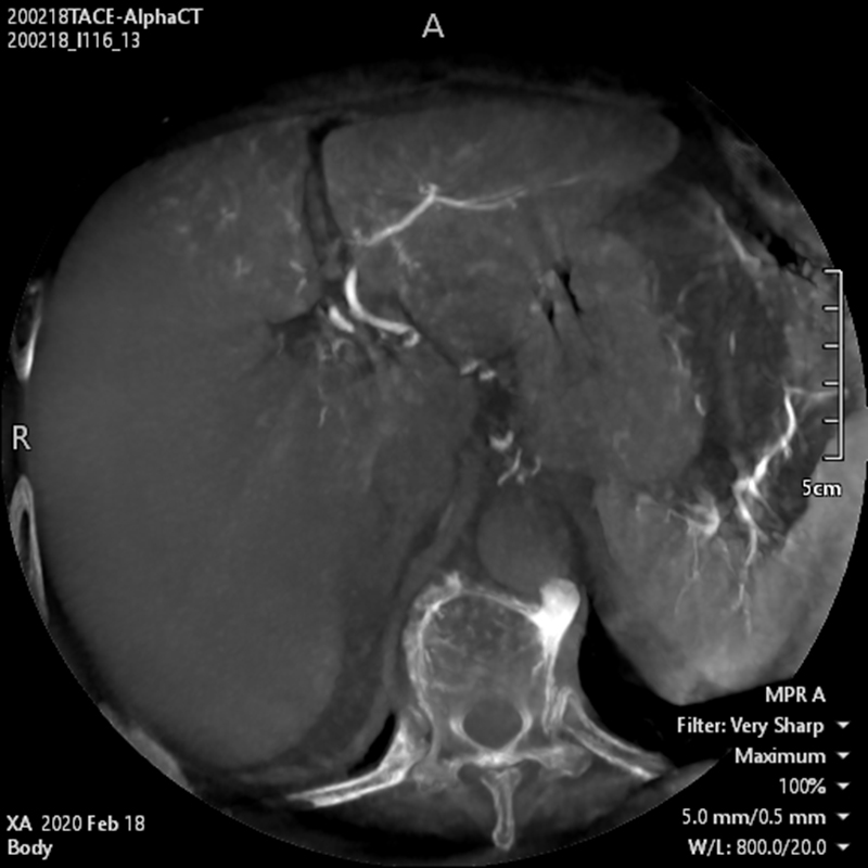 Alphenix Hi-Def imaging