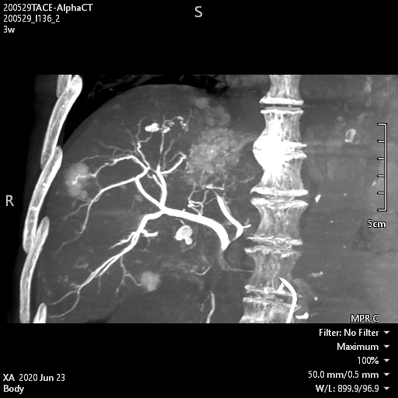 Alphenix Hi-Def imaging
