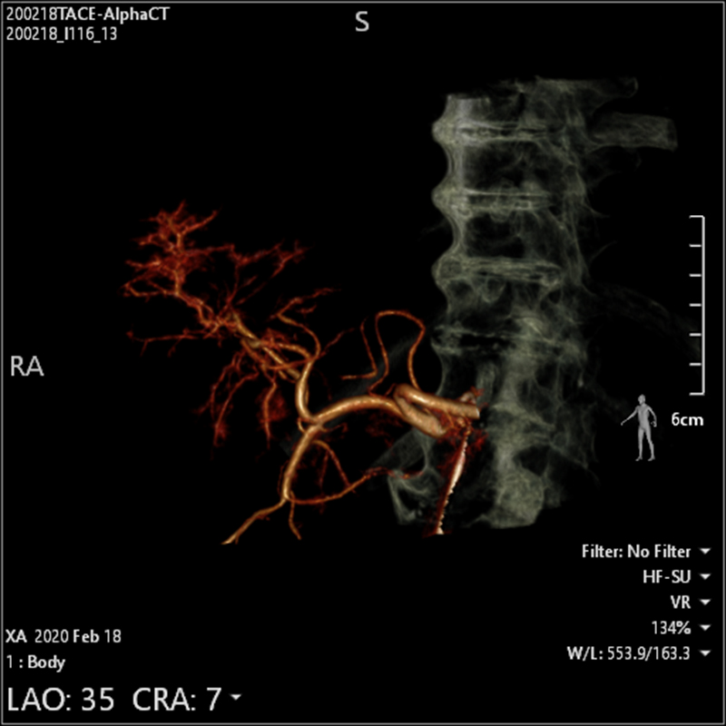 Alphenix Hi-Def imaging