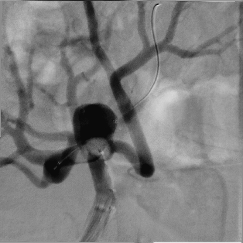 Alphenix Hi-Def imaging