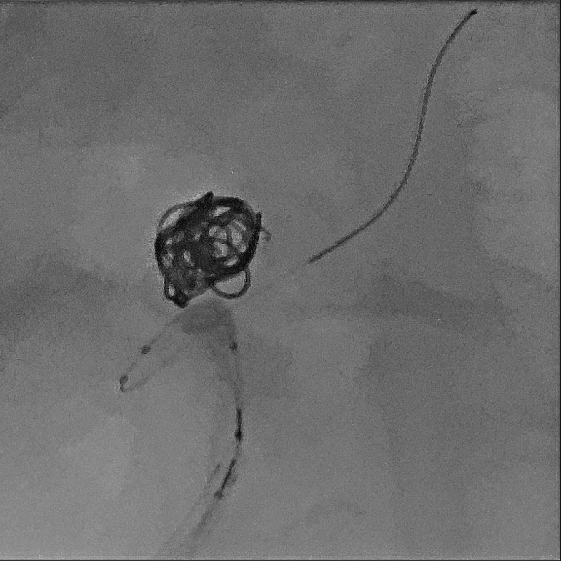 Alphenix Hi-Def imaging