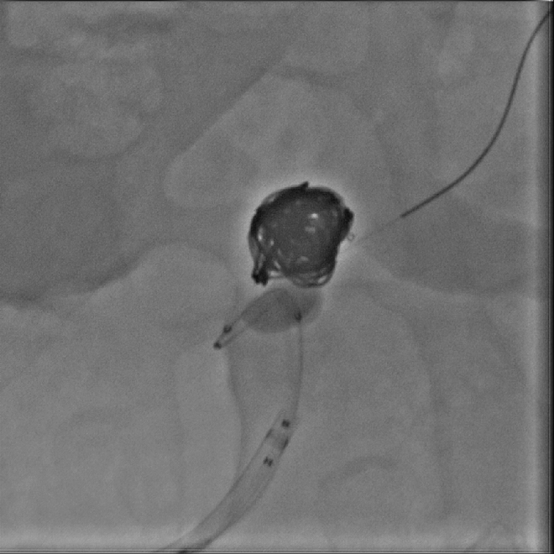 Alphenix Hi-Def imaging