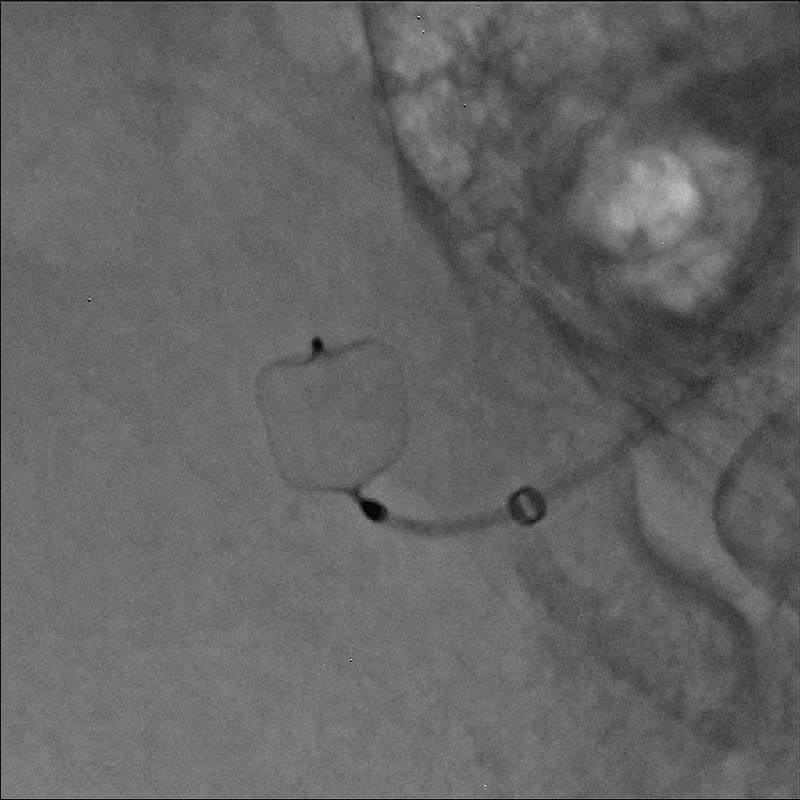 Alphenix Hi-Def imaging
