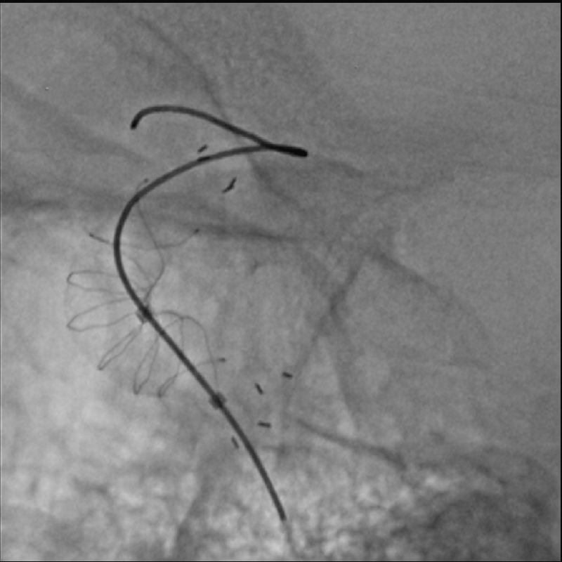 Alphenix Hi-Def imaging