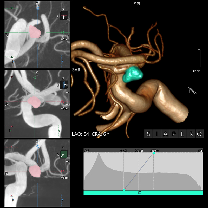 Alphenix 3D images