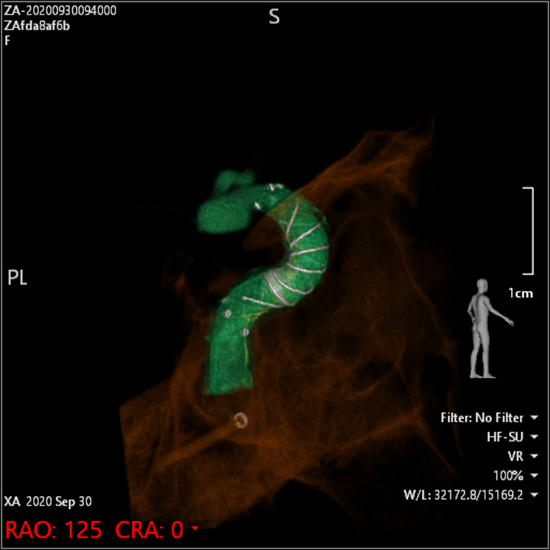 Alphenix 3D images
