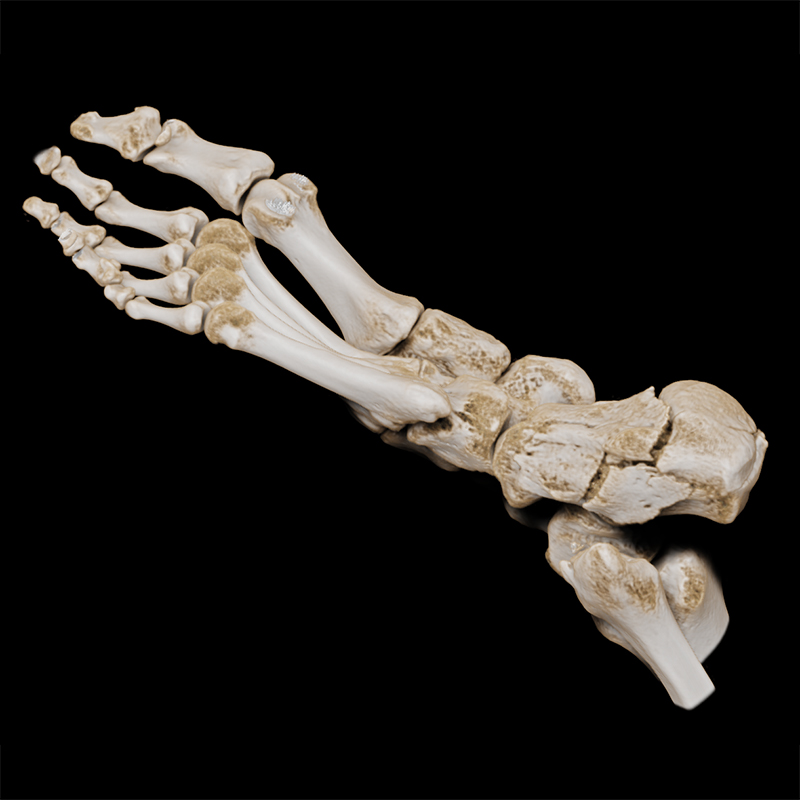 Global Illumination Foot