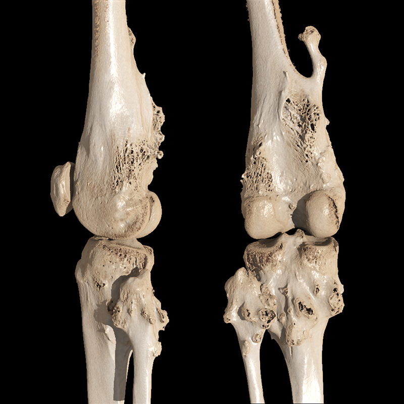 Global Illumination Knee