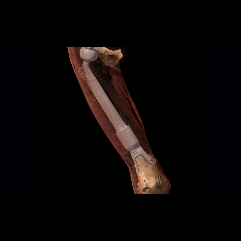 Global Illumination Leg