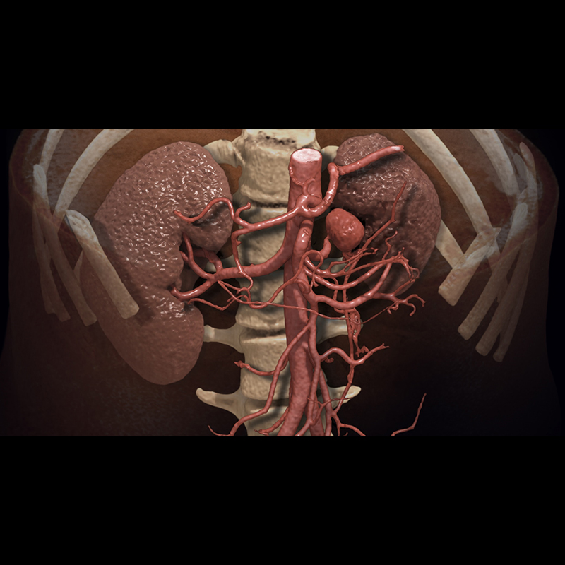 Global Illumination Abdomen