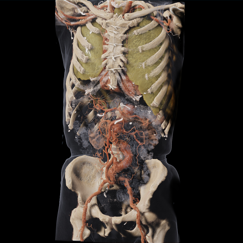 Global Illumination Body