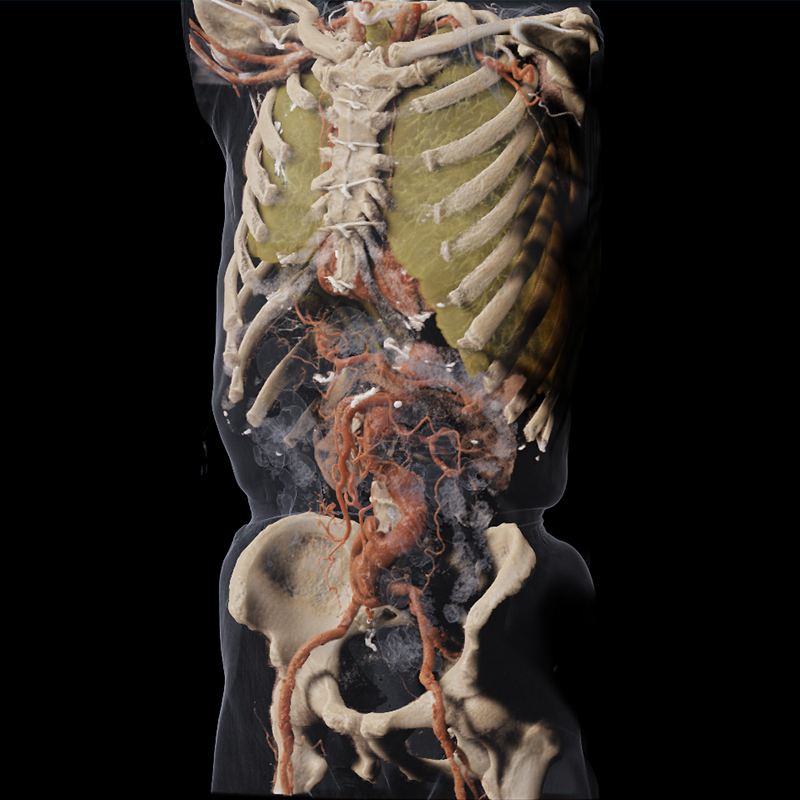 Global Illumination Body