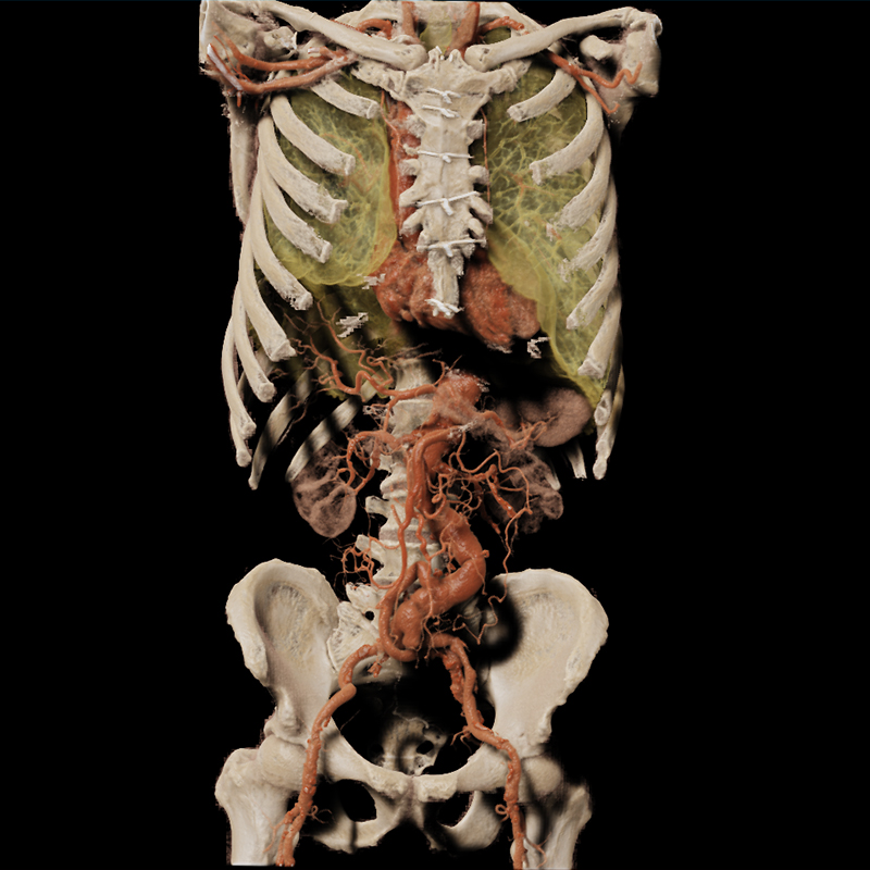 Global Illumination Body