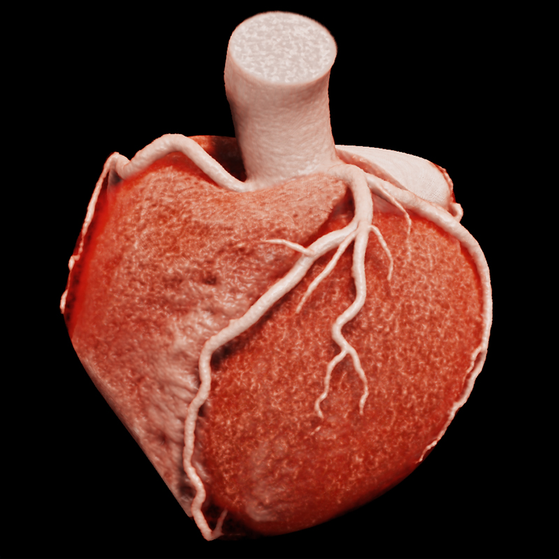 Global Illumination Cardiac