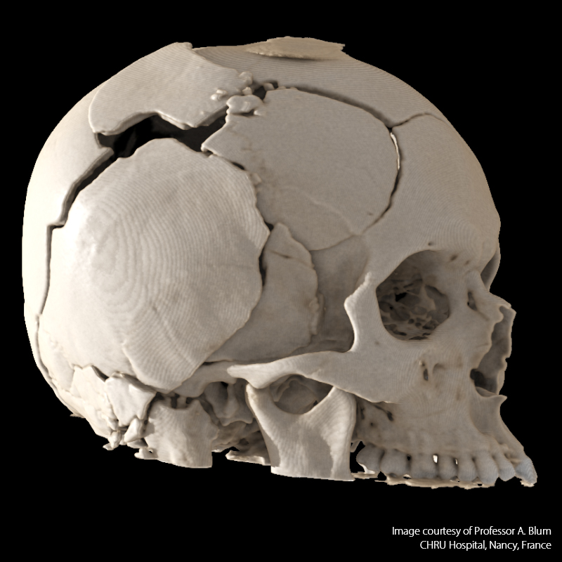 Global Illumination Head