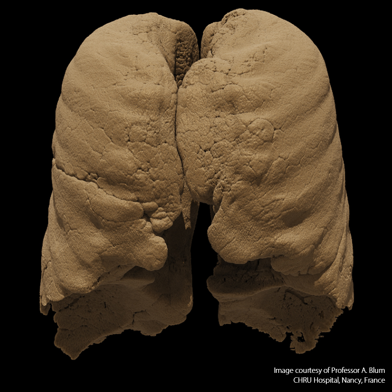 Global Illumination Lung