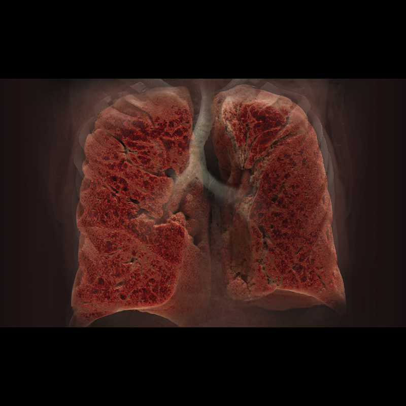 Global Illumination Lung