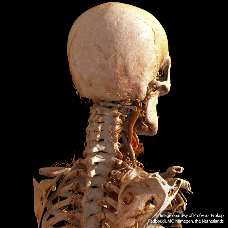 Global Illumination Neck