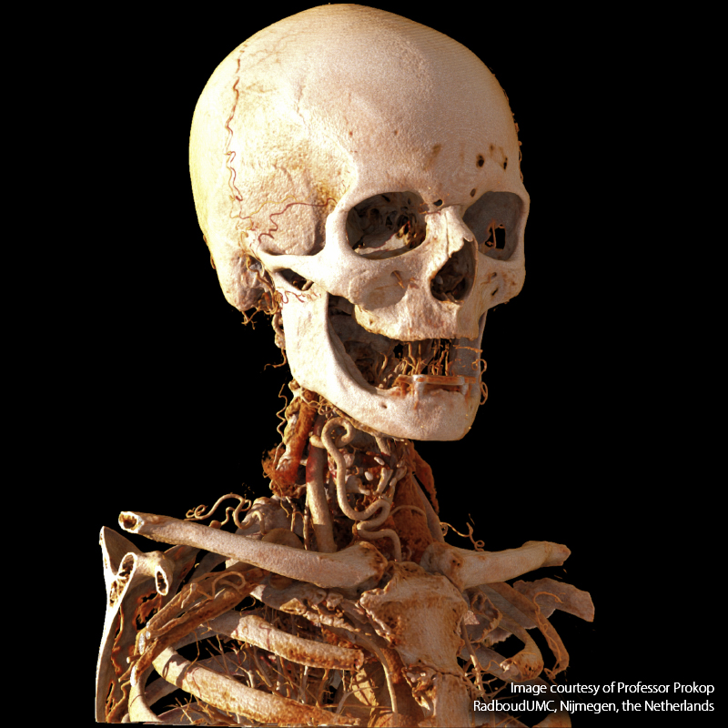 Global Illumination Neck