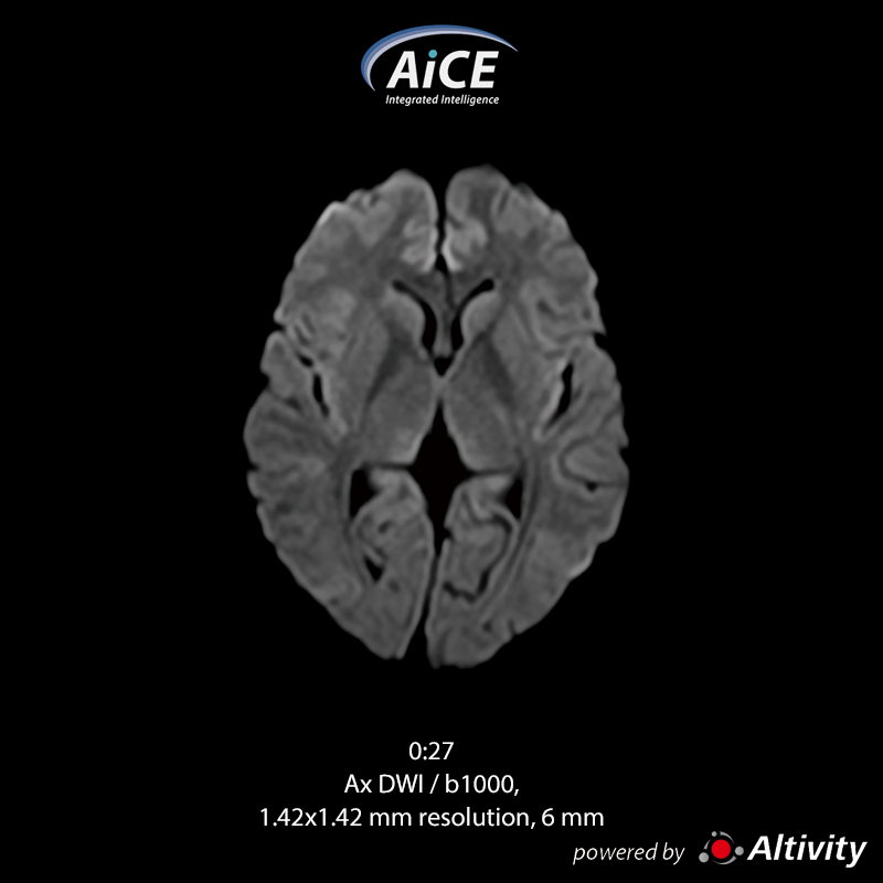 Vantage Fortian Fast routine brain examination