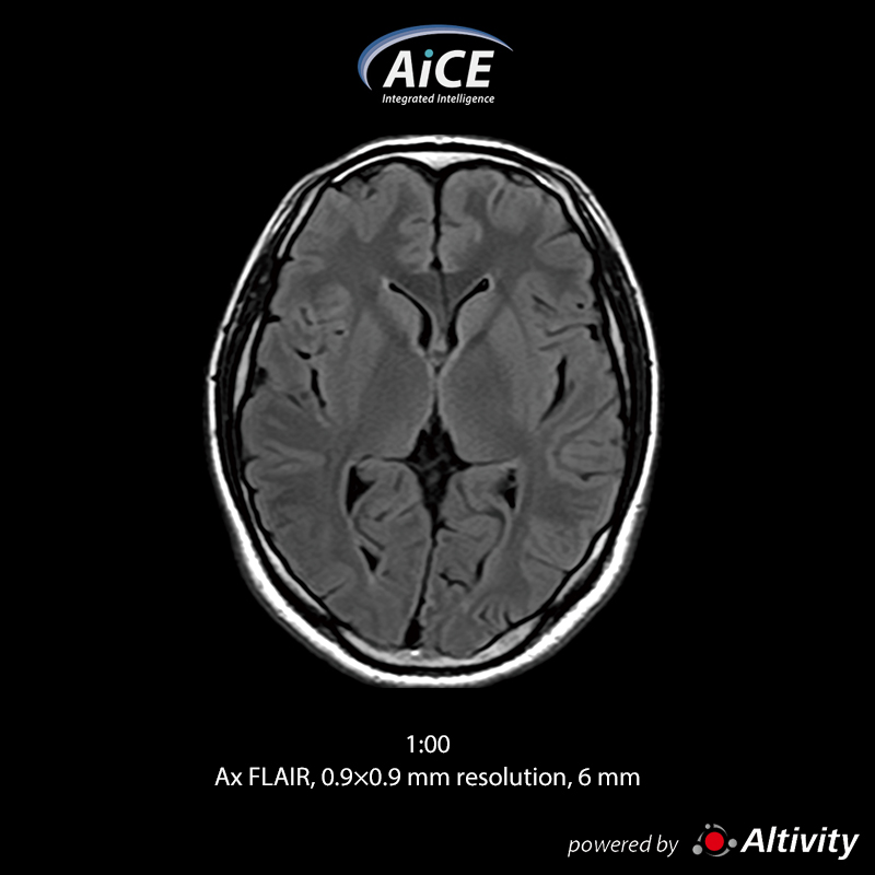 Vantage Fortian Fast routine brain examination