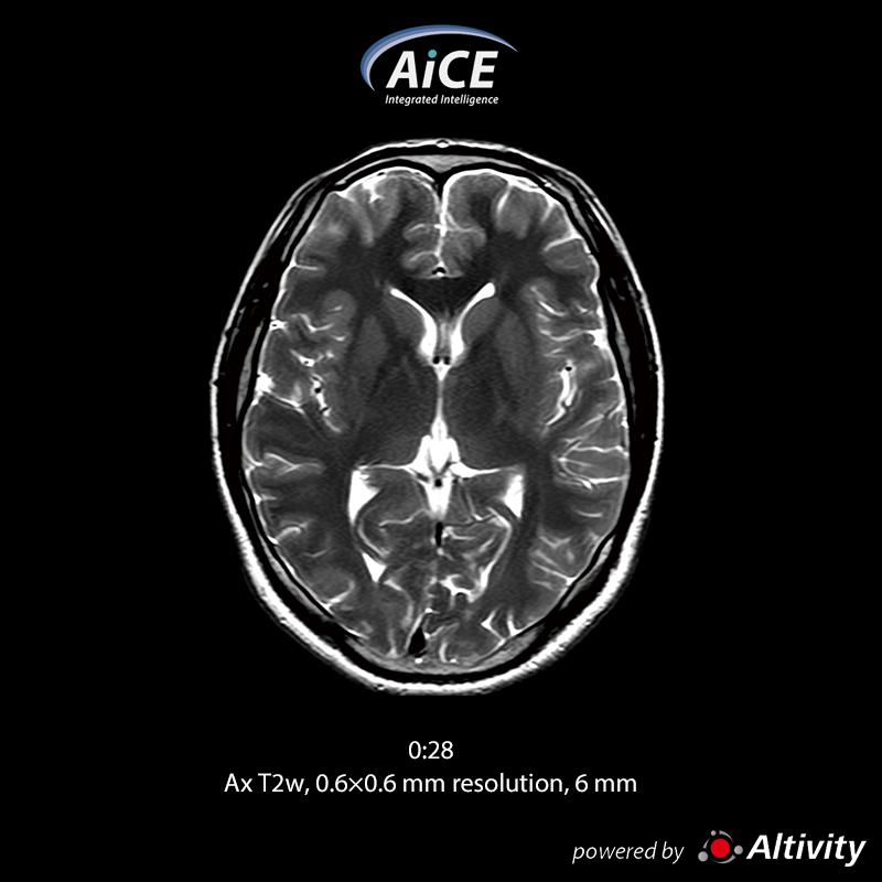 Vantage Fortian Fast routine brain examination