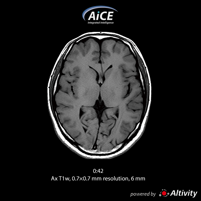 Vantage Fortian Fast routine brain examination