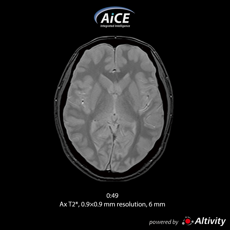 Vantage Fortian Fast routine brain examination