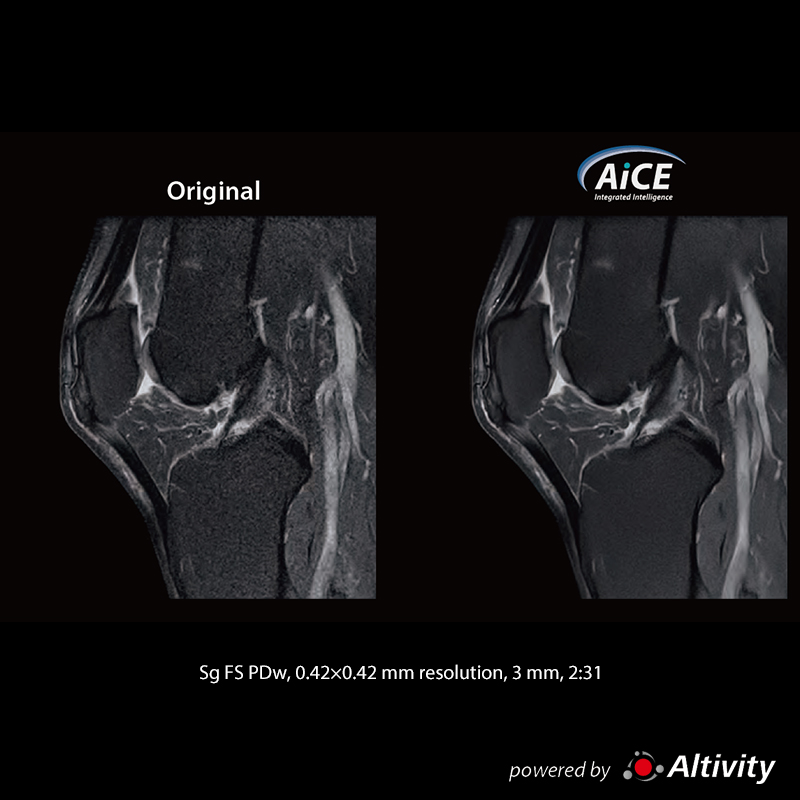 Vantage Fortian High-resolution knee images