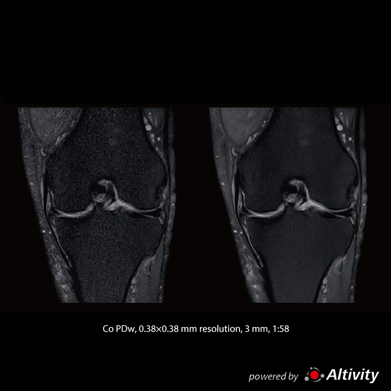 Vantage Fortian High-resolution knee images