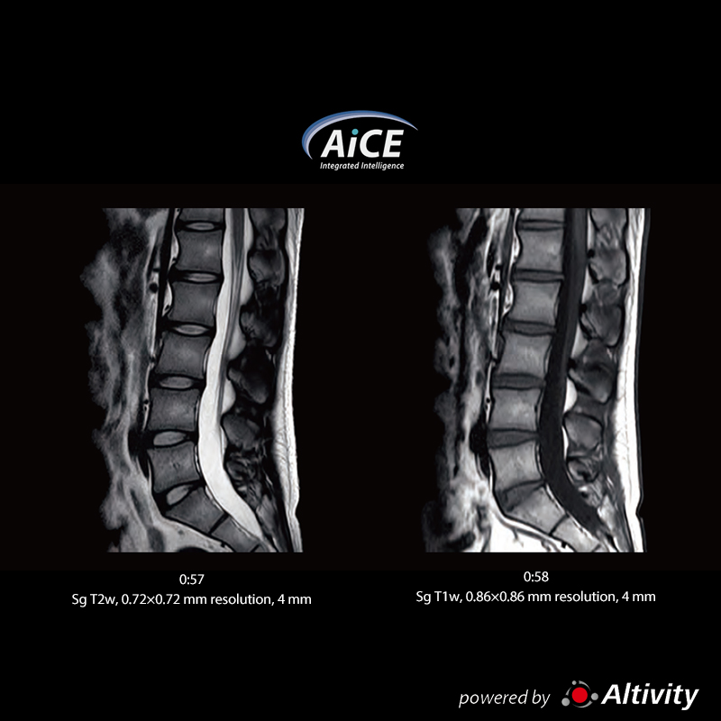 Vantage Fortian Fast routine L-spine examination