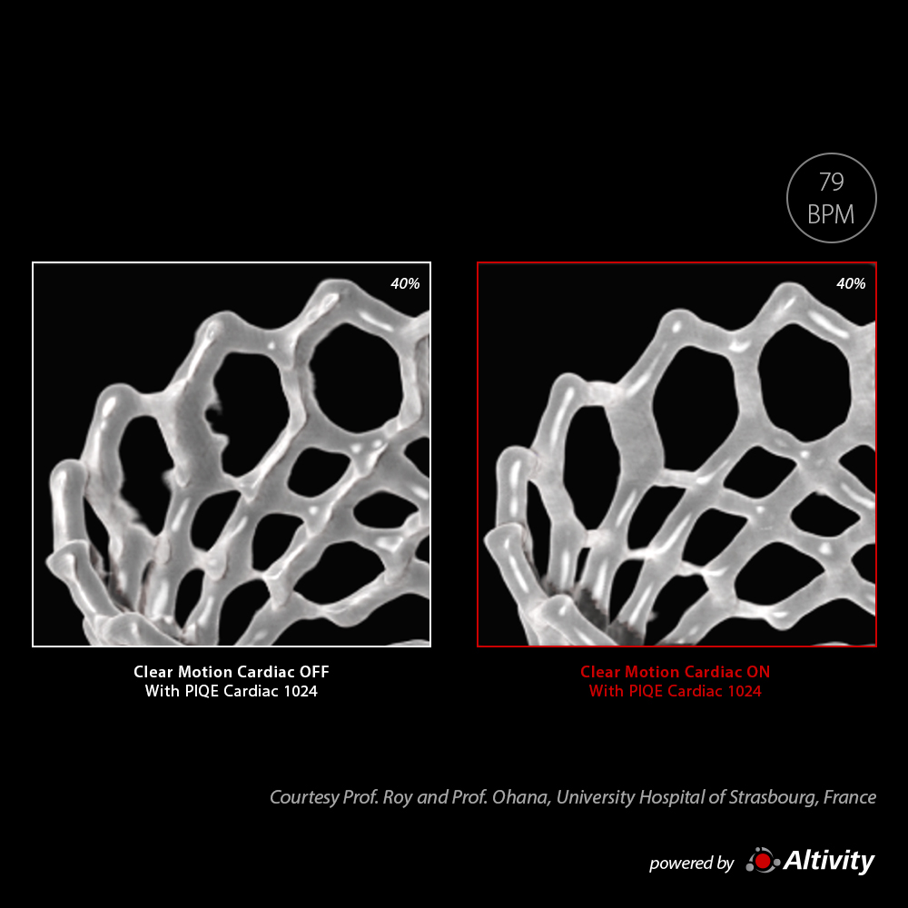 SAPIEN 3 Valve with CLEAR Motion Cardiac
