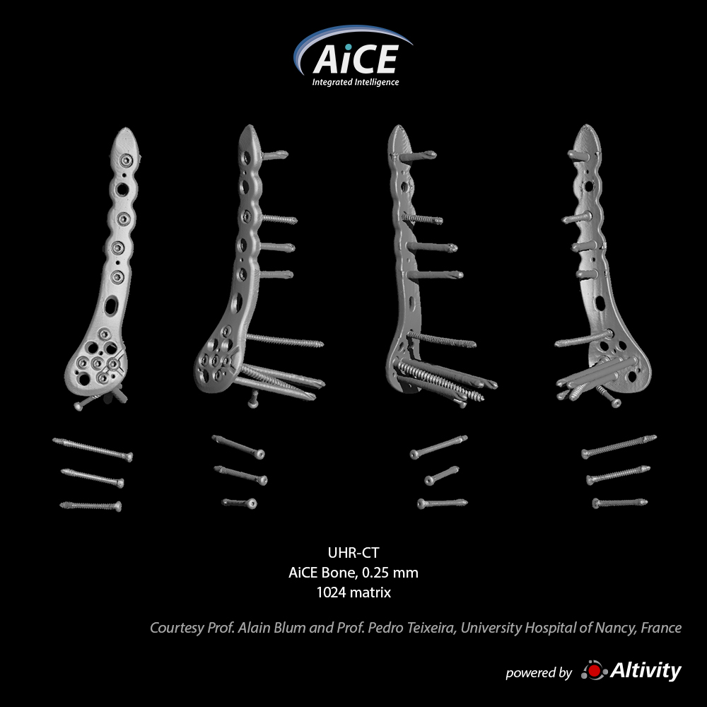 Aquilion Precision Knee-SEMAR