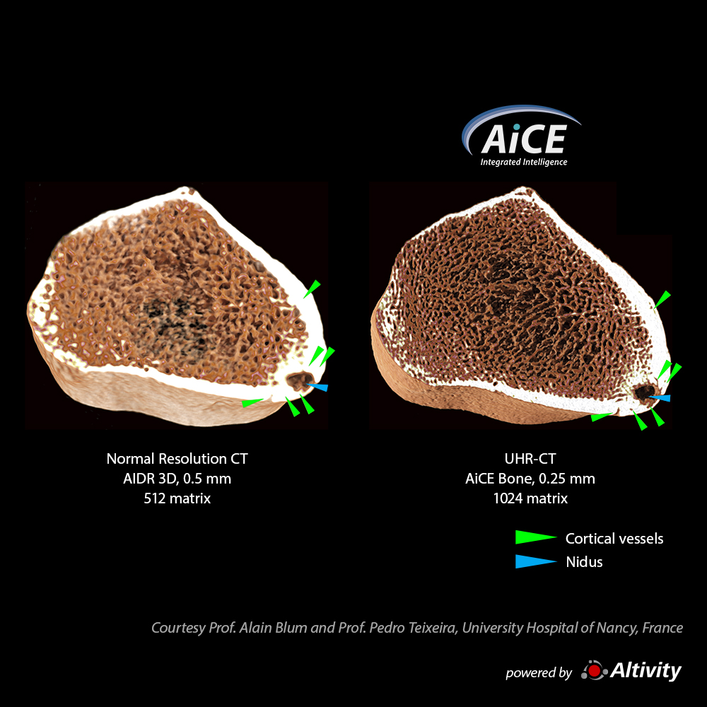Aquilion Precision Musculoskeletal 2
