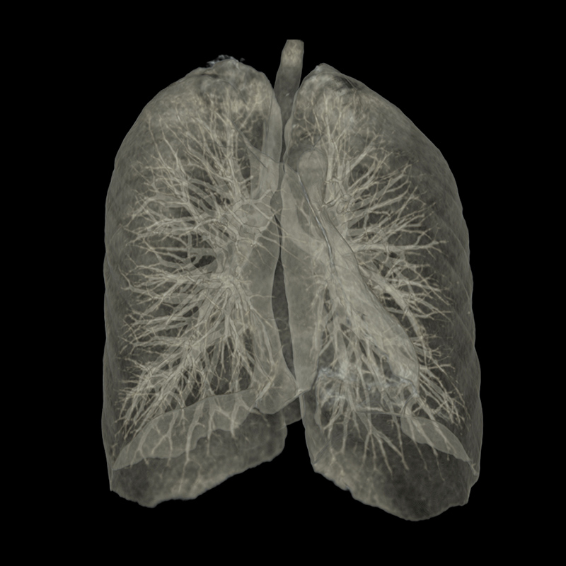 Aquilion Prime SP Lung Ultra-Low Dose
