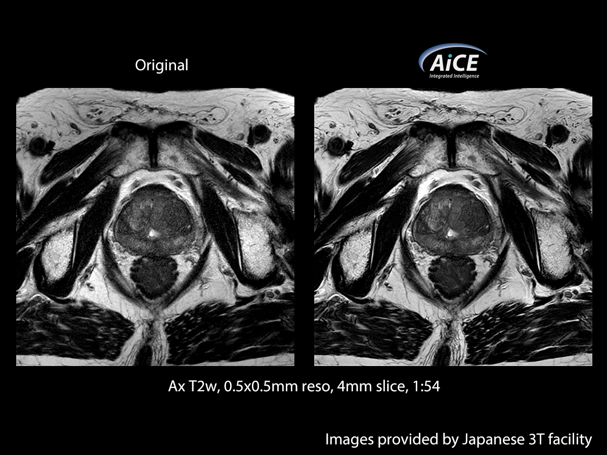 Advanced intelligent Clear-IQ Engine Abdomen