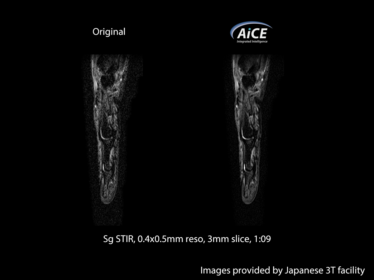 Advanced intelligent Clear-IQ Engine MSK1