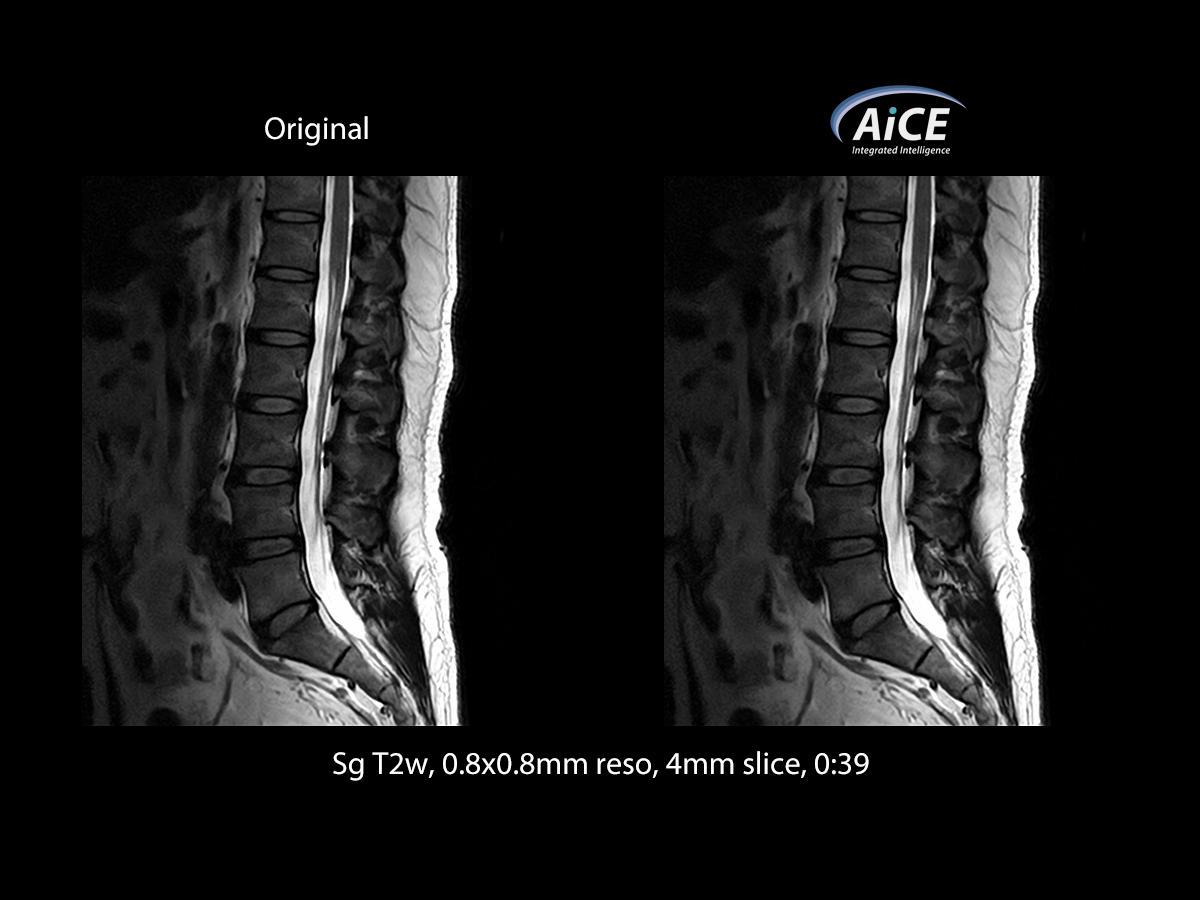 Advanced intelligent Clear-IQ Engine Spine